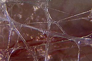 fascial manipulation in orange county physical therapy